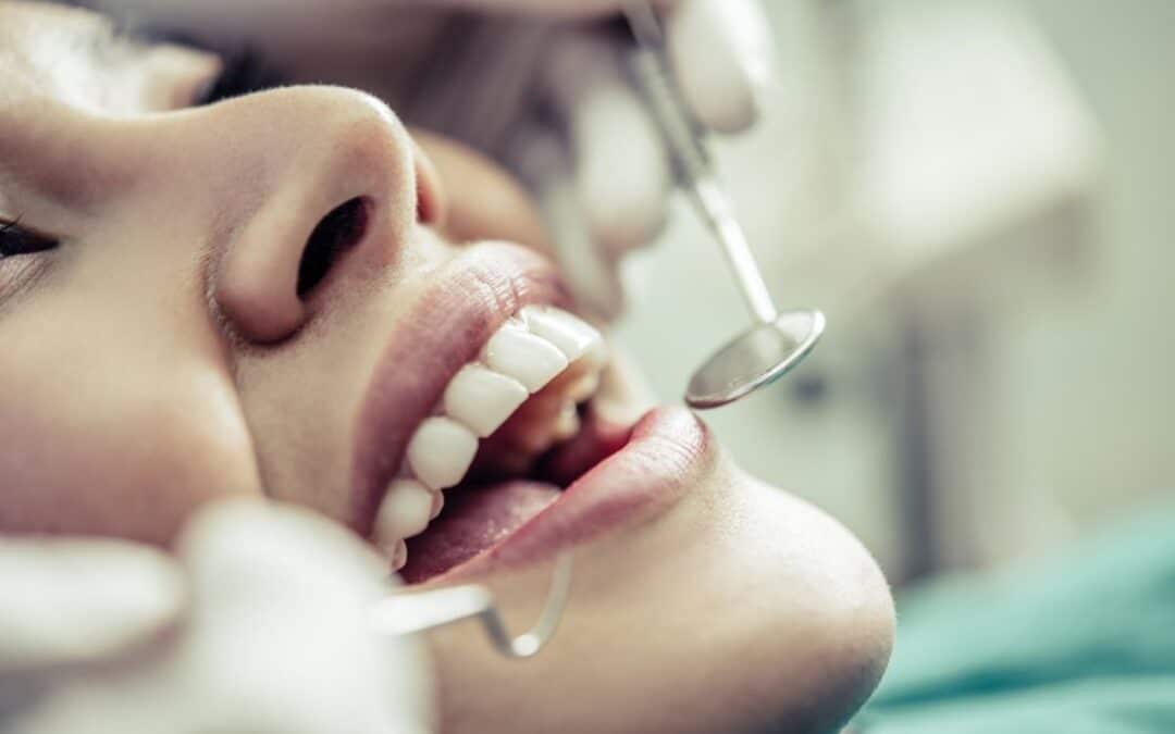 How to Reduce the Risk of Cavities?