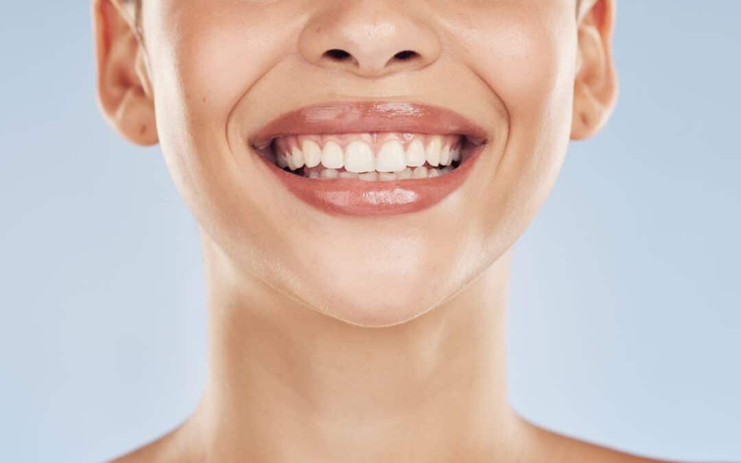 5 Ways to Whiten Your Teeth