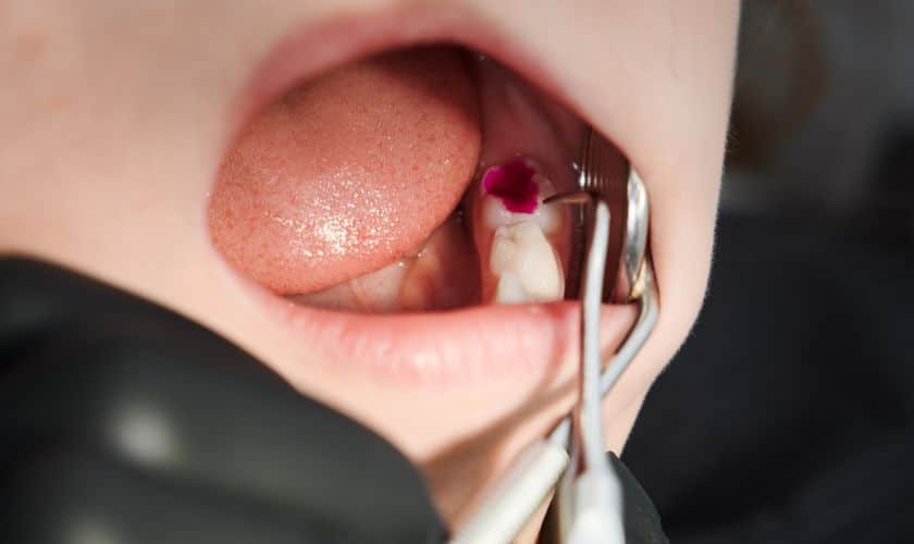 Emergency dentist in Falcon, CO