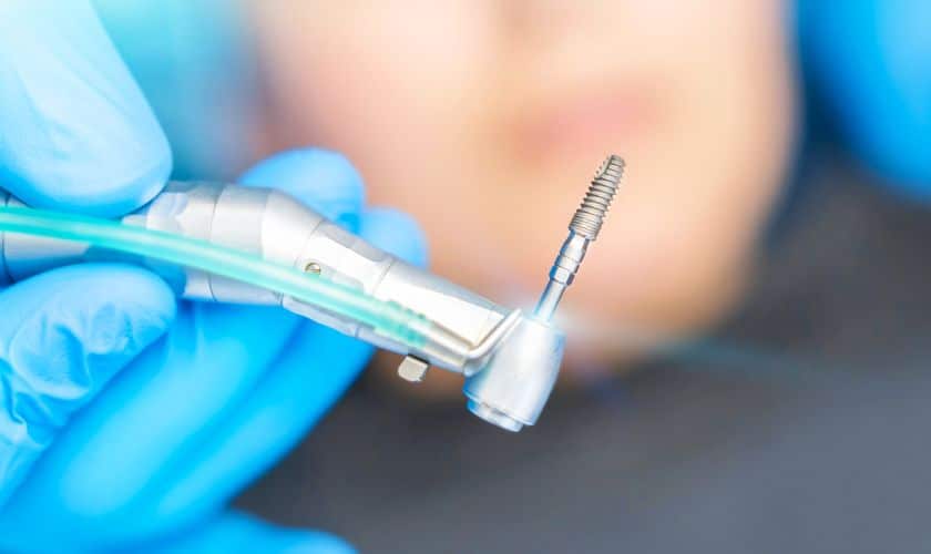 Dental Implants Colorado Springs