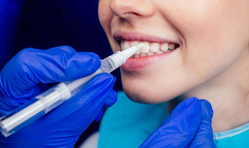 Dental Crown Colorado Springs