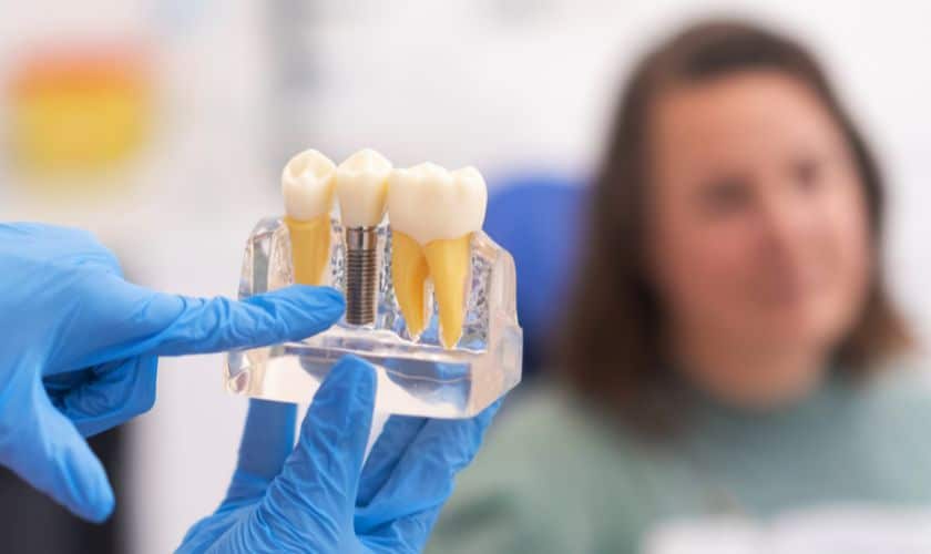 Dental Implants Colorado Springs