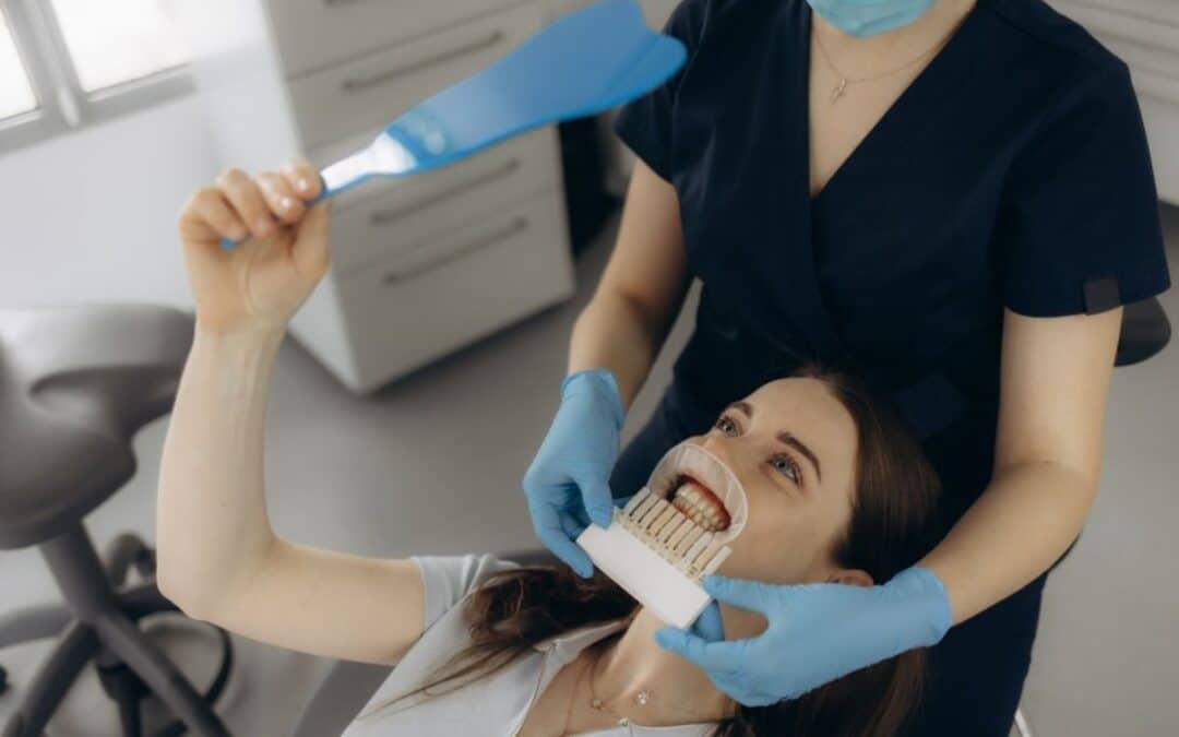 Tips To Keep Veneers Looking Brand New