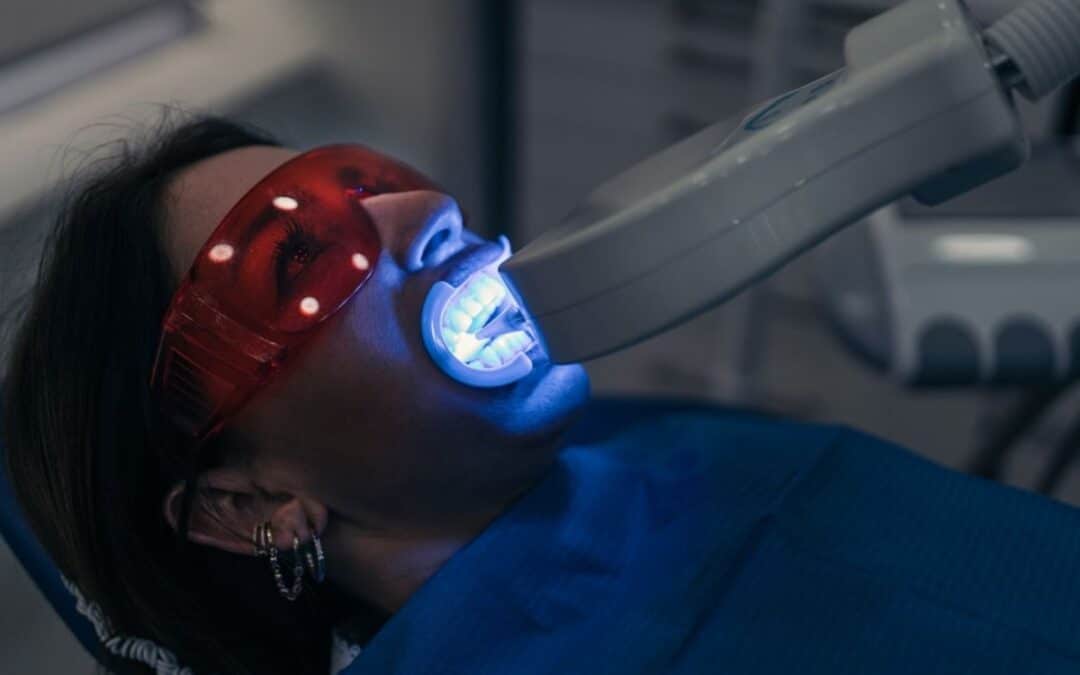 Why Patients Choose Teeth Whitening Before Weddings And Big Events