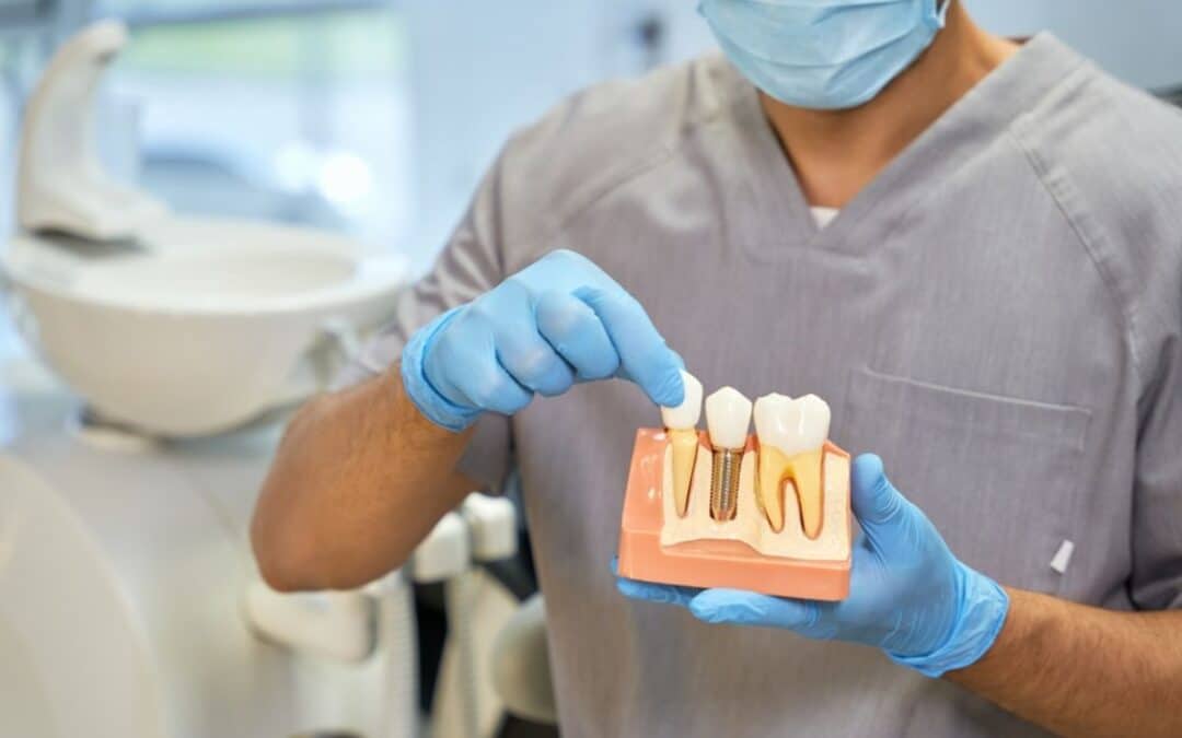 Breaking Down The Dental Implant Process Timeline