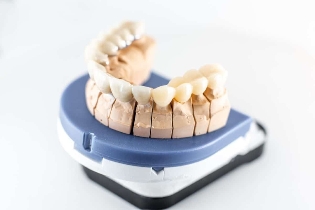 Dental Crowns
