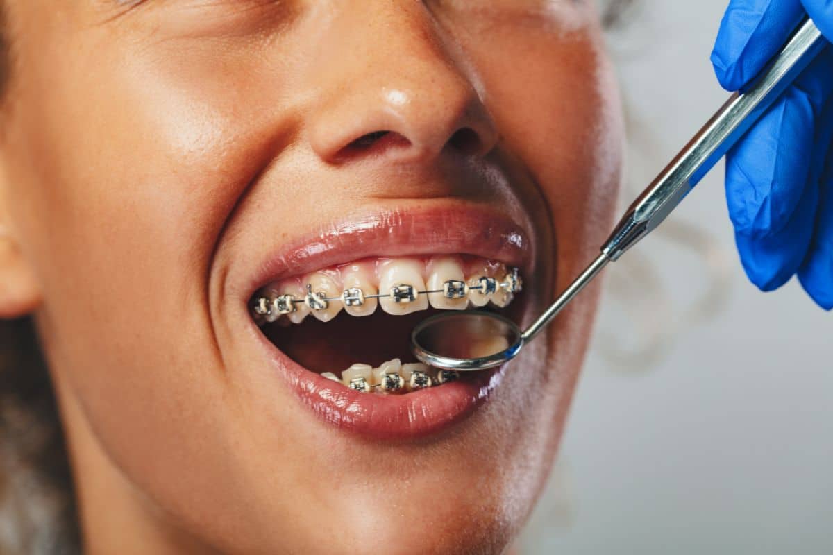 How Surgical Orthodontics Improves Bite and Jaw Alignment