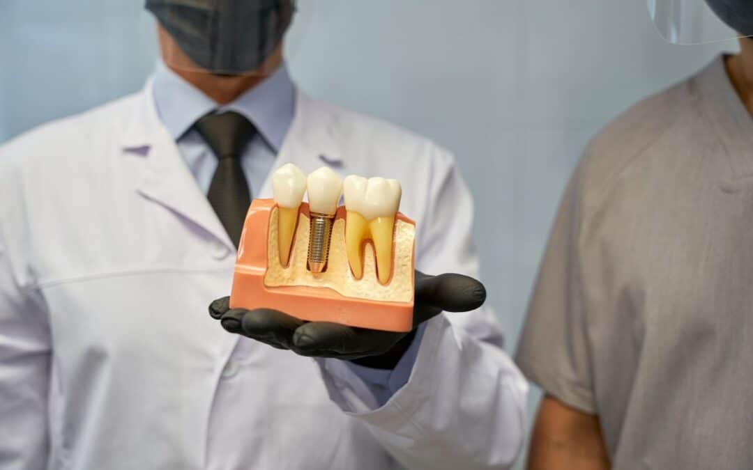 Helping Colorado Springs Residents Restore Their Smiles with Dental Implants