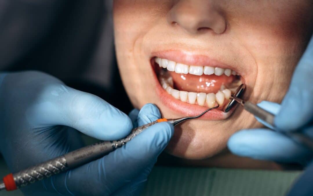 Why Oral Surgery in Colorado Springs Can Be Comfortable and Caring