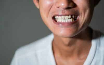 What’s The Best Way To Fix A Missing Tooth? If you In Colorado Springs
