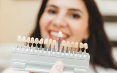 Is It Time to Replace Your Old Veneers? Key Signs of Wear and How Upgrades Have Improved