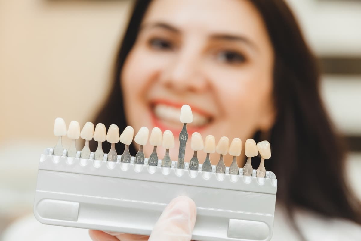 How to Tell If Your Veneers Need Replacing How to Tell If Your Veneers Need Replacing