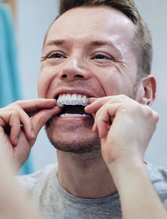 Patient inserting Invisalign clear aligners for discreet teeth straightening