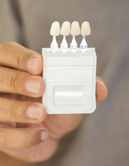 Porcelain veneers enhancing the appearance of teeth for a brighter, more balanced smile